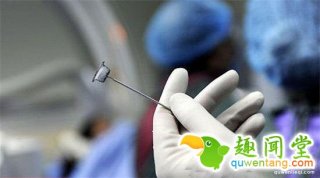 全球首例“换头术”为什么取消了？难道真