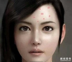 额头长痘是什么原因？从痘痘看出你的健康