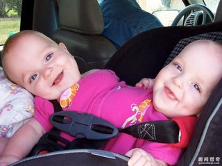 世界最罕见的连体婴，长大分开后的人生是