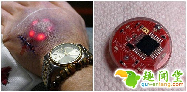 　　【环球网综合报道 】据英国《每日邮报》11月11日报道，纹身似乎已经是过时的潮流了。近日，德国几名男子便将LED灯植入皮肤下。他们是将一种带着LED灯的芯片植入了手中，这种芯片大小就像一枚大的硬币。这种设计可以从皮肤下面点亮皮肤上的纹身图案，可以获得水母身体发光一般的效果。