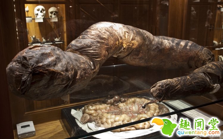 【深夜毒物】相信我，这家藏有奇异人体的博物馆你不会想进去的