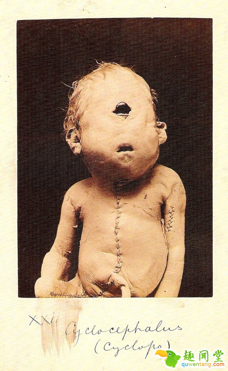 【深夜毒物】相信我，这家藏有奇异人体的博物馆你不会想进去的