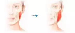 女人越长越丑，全是因为这20个坏习惯！