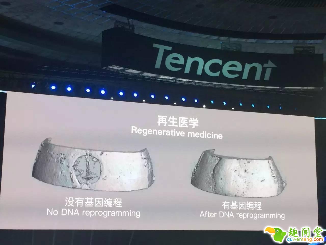 返老还童将成真,斯坦福教授解说