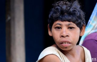 现实世界的人猿泰山，两兄妹酷似猩猩，和