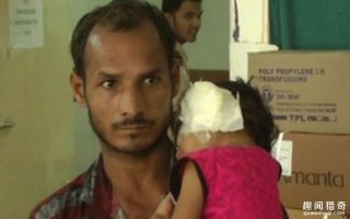 吓人！印一小女孩耳中取出80多条虫子，差