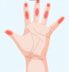 7种手痛代表身体已经在发出健康警讯，如